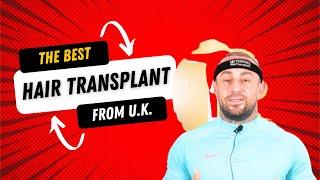 From #uk #hairtransplant #transes #transeshairtransplant