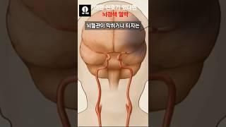 지금 바로 여러분도 측정해보세요 #궁금증 #상식 #의학 #뇌졸중전조증상