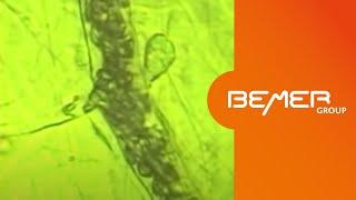 The BEMER Effect - microscopic demonstration of the effect on microcirculation | EN