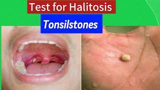 Test for Halitosis (Tonsilstones).