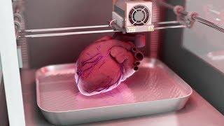 How medical 3D printing could solve the shortage of organ donations