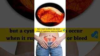 Ovarian Cysts #shorts #foryou