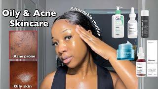 SKINCARE ROUTINE FOR OILY ACNE-PRONE SKIN | A routine for smooth & clear Skin ‼️