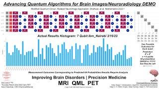 Advancing Quantum Algorithms for Brain Images Neuroradiology DEMO