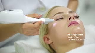 PURISMA - Plasma Skin Rejuvenation by Daeyang Medical