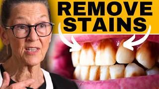 How to remove stains on teeth at-home