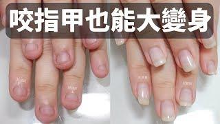 The nail biting can also be transformed into a big body - correcting the nail and making art nails