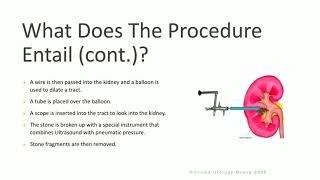 PNL for Kidney Stones