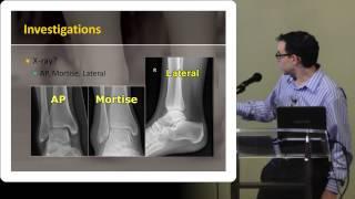 The Foot and Ankle Exam:  What You Need to Know