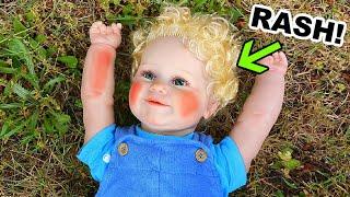 Reborn Baby Boy Gets A Rash Role Play