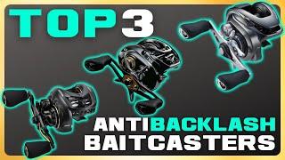 Top 3 Anti-backlash Baitcasters