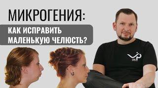 Микрогения. Как исправить маленькую челюсть?