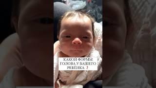 ЭТО ВАЖНО ЗНАТЬ! КАКОЙ ФОРМЫ ГОЛОВА МАЛЫША #онлайнконсультации #малыш #груднички #малыш