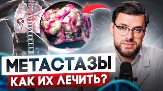 Что такое МЕТАСТАЗЫ и как их ПОБЕДИТЬ? Секреты лечения