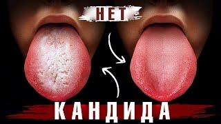 Начните делать это сейчас – и избавитесь от кандидоза навсегда!