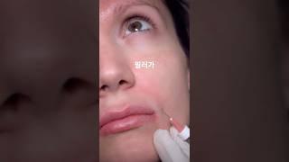 필러 vs 스킨부스터, 완벽 비교해드림!️