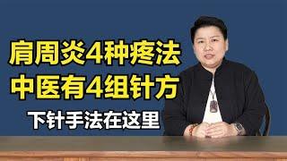 肩周炎有4种疼法，中医4组针方教给你，下针手法也都有！