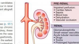 Medicine 0433 Acute Kidney Injury Renal Failure Chronic