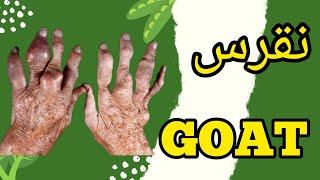 نقرس:بیماری نقرس را بشناسید #نقرس #GOUT