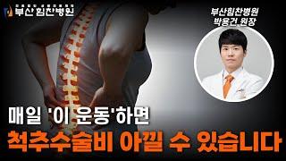 척추 질환의 양대산맥 척추관협착증과 추간판탈출증, 척추에 좋은 '이 운동'은?