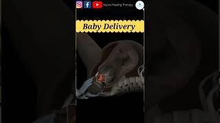 Baby Delivery Animation #surgerysimplified #birth #baby