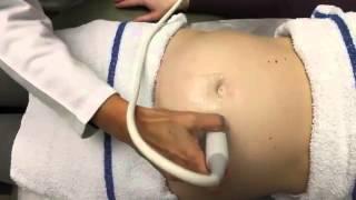 Ultrasound in Obstetrics & Gynecology: A Practical Approach - Clip 10.3