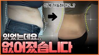 제 뱃살이 이랬는데 요래됐슴당~ #서울365mc #지방흡입후기 #복부지방흡입