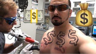 Laser Tattoo Removal COST | HOW MUCH