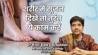 शरीर में सूजन दिखे तो तुरंत ये काम करें...Dr Arati Dave Lalchandani #healthytips