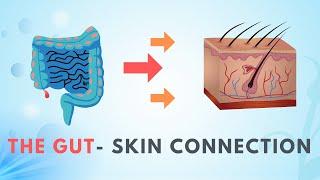 The Gut-Skin Axis | 5 Surprising Ways An Unhealthy Gut Can Cause Skin Problems