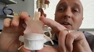 Diurnal and real time spine movement - Dynamic Disc Designs Corp.