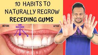 10 ways to Heal Receding Gums | Treat Gum Diseases | prevent Periodontitis