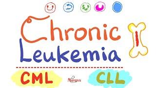 Chronic Leukemias - CML and CLL  - Hematology / Oncology