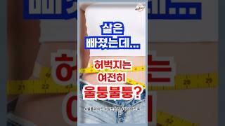 살은 빠졌는데 허벅지는 여전히 울퉁불퉁 ? #셀룰라이트#림프마사지#부종빼는방법#다이어트 #꿀팁 #영양식 #이슈