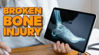 How Much is a Fracture Injury Lawsuit Worth | Broken Bone Injury | Broken Fracture | Ethen ostroff