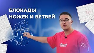 Блокады ножек и ветвей