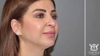 Sydney & Canberra Specialist Plastic Surgeon Dr Ross Farhadieh on Rhinoplasty