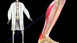 Achilles Tendon Stress & Strain - Everything You Need To Know - Dr. Nabil Ebraheim