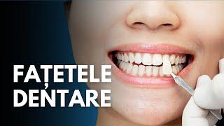 Fațetele dentare: Avantaje și dezavantaje explicate de Dr. Gabriel Leuștean | Sănătate cu Prioritate