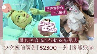 整容｜內地女誤信醫美廣告由變美慘變毁容！一針斷送終身健康｜01女生｜醫美｜毁容｜美容