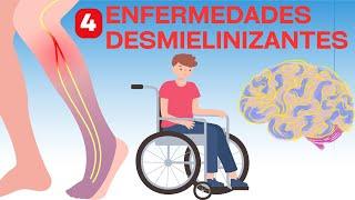 Las 4 enfermedades desmielinizantes más importantes