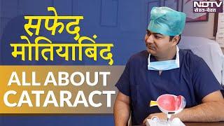 All About Cataract | सफ़ेद मोतियाबिंद - जानें कारण, लक्षण, उपचार | Dr Rahil Chaudhary on NDTV