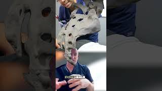 Coccydynia: Ultimate Pain in  Buttocks  #shorts