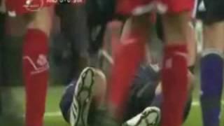 terrible leg crack from tackle of Witsel on Wasilewski