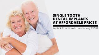 dental implants kallangur brisbane northside