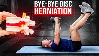 Reverse Disc Herniation with 3 Exercises for Lasting Relief & Nerve Health!