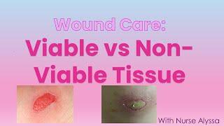 Viable VS non-viable tissue