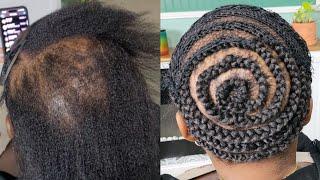 THE BEST CROCHET BRAID PATTERN FOR THINNING HAIR | Tips & Tricks For Full Hair