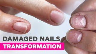 The BEST Nail Transformation Strategy Nobody Tells You | Dual Form Nail Extensions