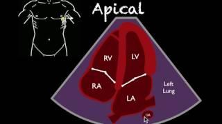 Bedside Ultrasound Basic Cardiac US